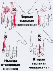 Точки спины что болит