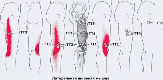 Точки спины что болит