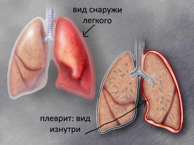 болит верх правого бока отдает в спину