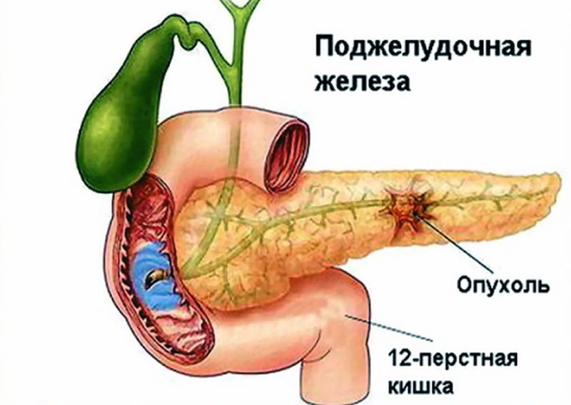 Болит сзади вся спина рак