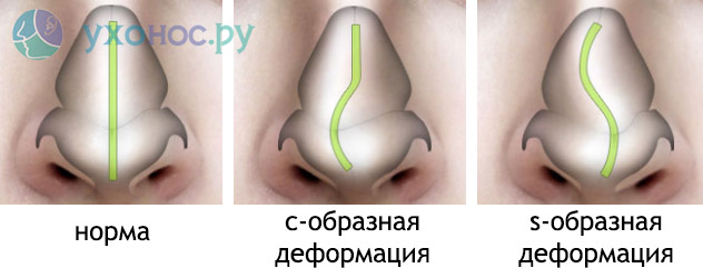 55442930293