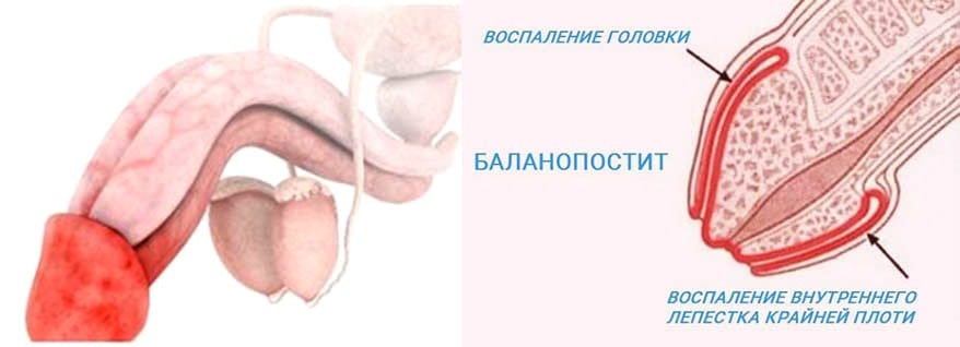 Почему от секса болит спина