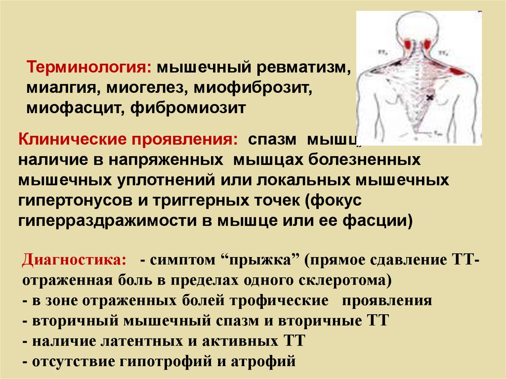 Миогелез