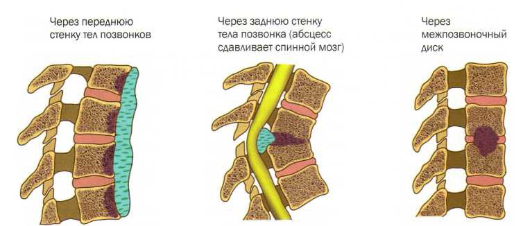 Если отекают ноги и болит спина