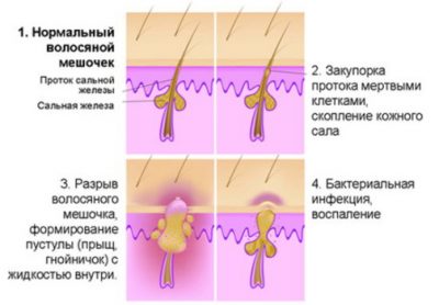 Что такое когда болит кожа головы и выпадают волосы