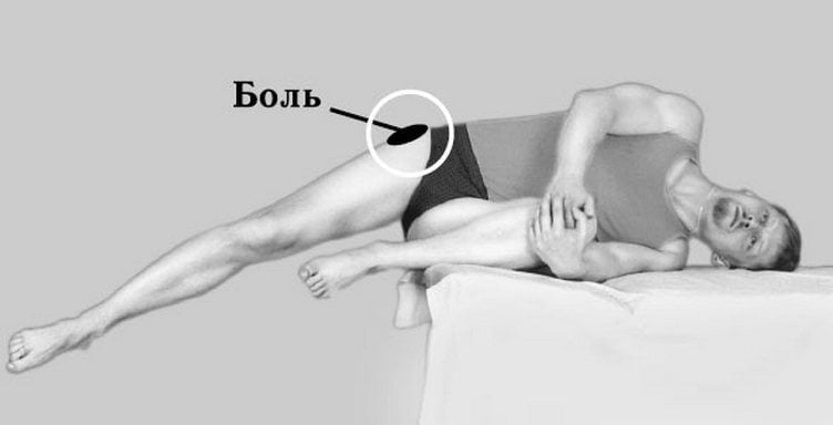 Боли в тазобедренном суставе лежа на боку Боль в тазобедренном суставе