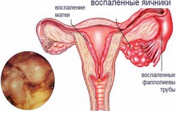 Почему от секса болит спина