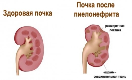 Болит низ живота и спина ниже поясницы