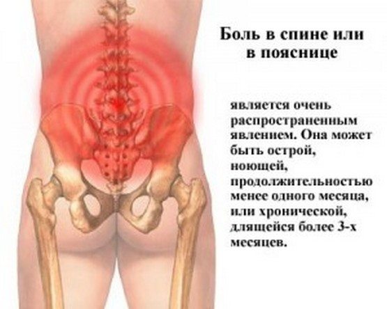 Виды болей в спине Боли в спине и пояснице