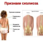 После бега болит спина поясница