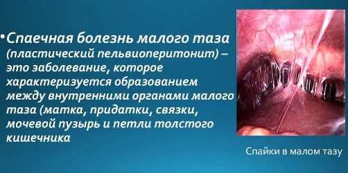 Почему от секса болит спина