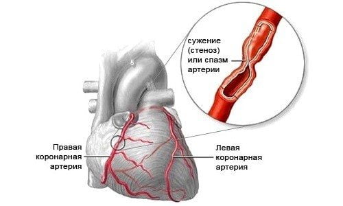 Болит середина позвоночника отдавая в спину