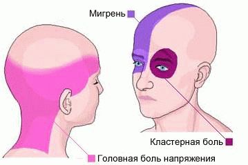 Сильно болит голова в лобной части и не помогают таблетки