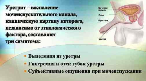 Почему от секса болит спина